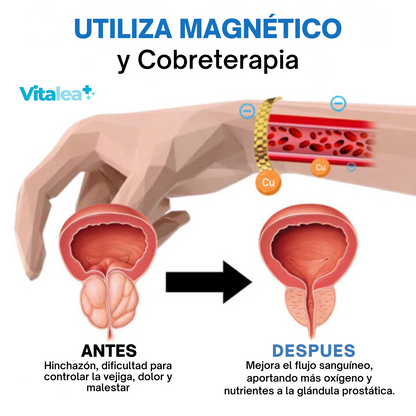 Fivfivgo™ Banda magnética de cobre para la próstata🧲