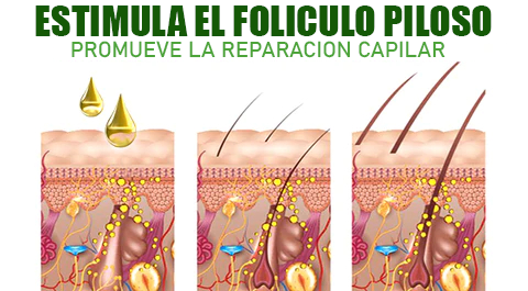 1+1 GRATIS| SPRAY PARA ALOPECIA - HyperSpray™